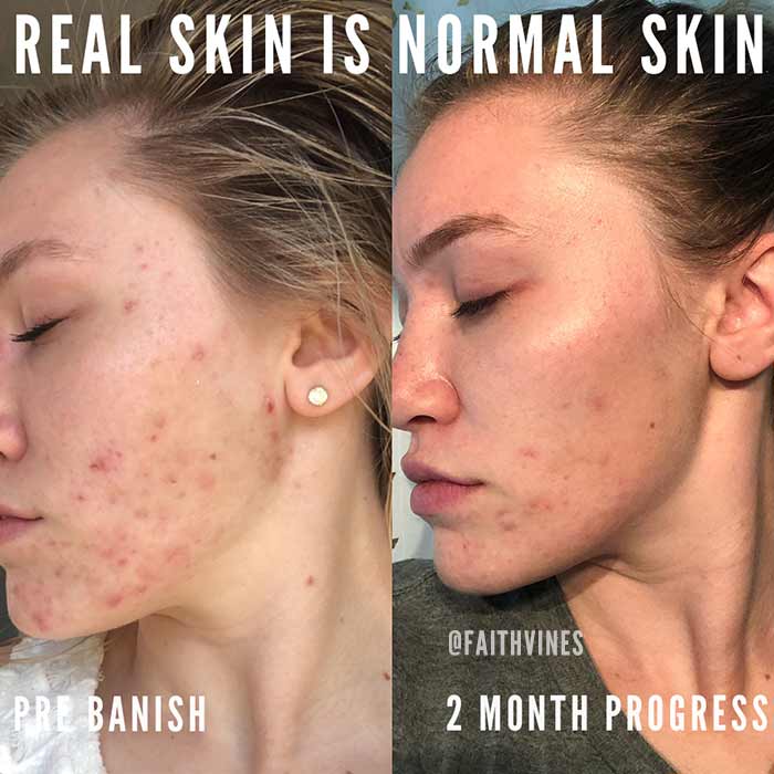 All Clear Mint Cleanser - Image 3
