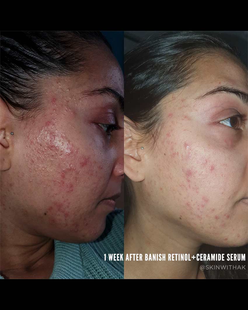 Retinol + Ceramide Serum - Image 3
