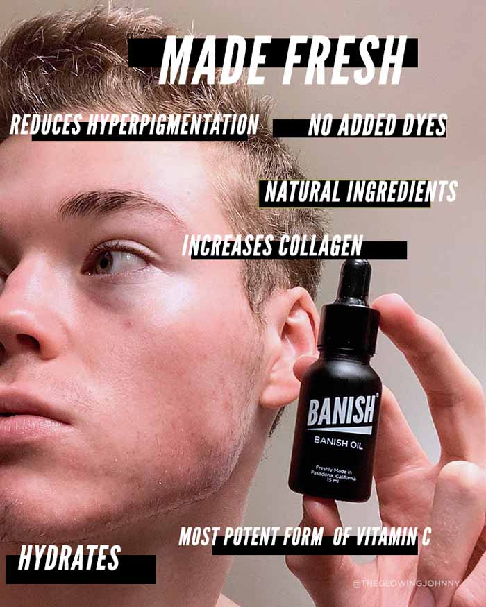 Banish Serum - Vitamin C Serum Dark Spot Corrector - Image 5